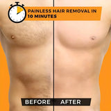 Sydonic Permanent Hair Removal Treatment | Facial & Body