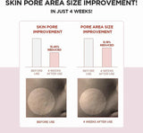 Skin 1004 Centella Poremizing clear Toner 210 ML