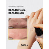 COMBO COSRX -SNAIL ESSENCE+ SNAIL CREAM